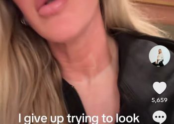 Ellie Goulding otkriva šokantne bolne rezultate iz kozmetičkog liječenja dok kaže ‘odustajem’