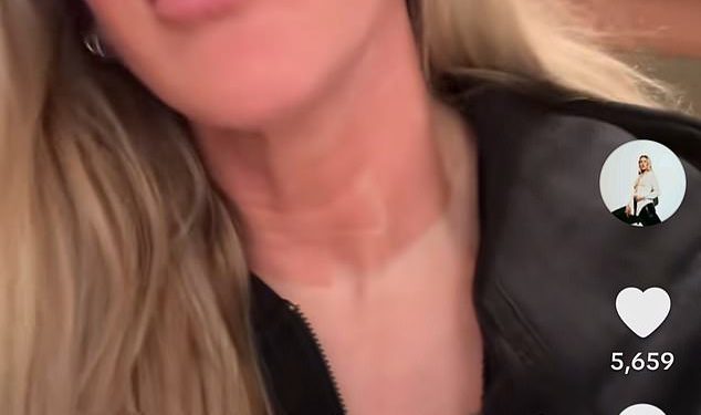 Ellie Goulding otkriva šokantne bolne rezultate iz kozmetičkog liječenja dok kaže ‘odustajem’