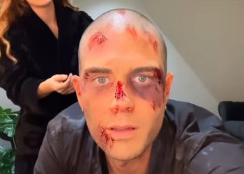 Max George i Maisie Smith prekriveni su lažnom krvlju dok dijele rijetki BTS isječak na sceni