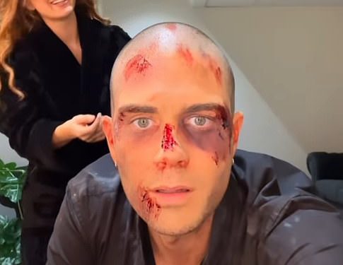 Max George i Maisie Smith prekriveni su lažnom krvlju dok dijele rijetki BTS isječak na sceni