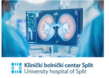 Odlične vijesti iz KBC-a Split: Odobreno obavljanje djelatnosti transplantacije bubrega