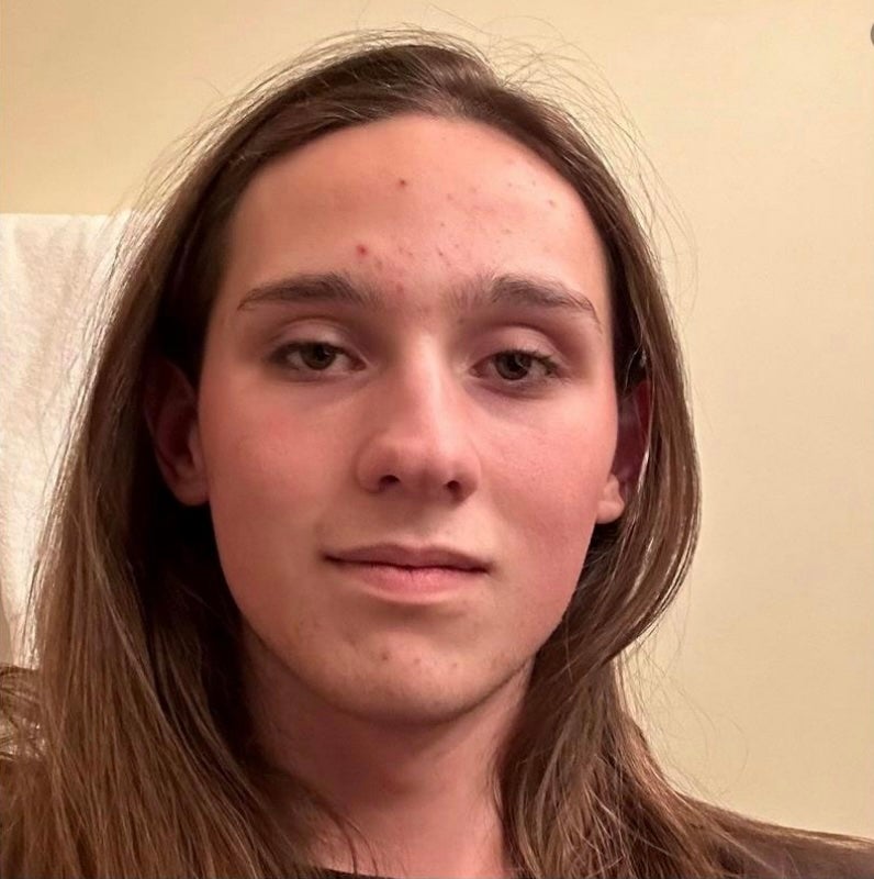 McIntire, 19-godišnji student na Sveučilištu u Bostonu u Massachusettsu, pojavio se u petak na saveznom sudu i optužen je za jednu tačku nezakonitog posjedovanja neregistriranog destruktivnog uređaja i jednu točku zlonamjerne štete vatrom bilo koje imovine koja se koristi u međudržavnoj trgovini.