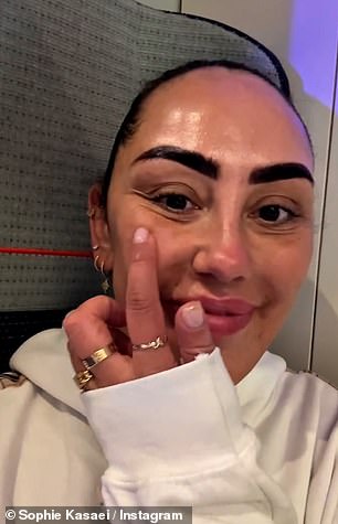 Zvijezda Geordie Shore (35) ispričala je kako je na TV -u ostavila osjećaj nesigurnosti u svom izgledu i ona se prijavila na operaciju nakon što su joj ponudili besplatne postupke u inozemstvu (na slici prije)