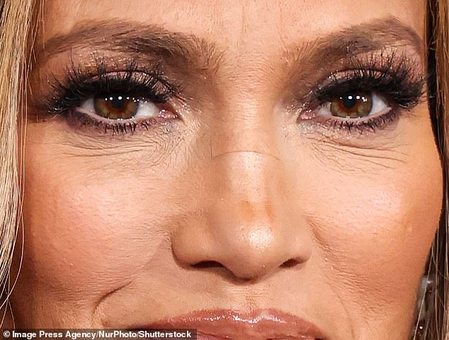 Međutim, pomniji pogled otkrio je da je Lopez skrivao ozlijeđeni nos sa zavojem od tona mesom ili ožiljkom