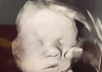 Božja ruka na ultrazvuku: Čudesna snimka trudnice iz Cincinnatija dirnula tisuće vjernika