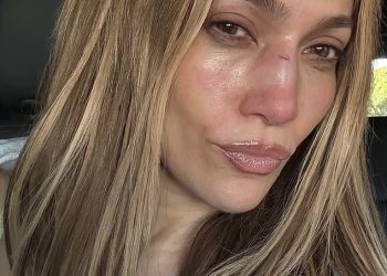 Jennifer Lopez trpi gadnu ozljedu lica nakon nesreće na pozornici
