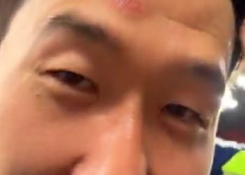 Kapetan Tottenham, sin Heung-Min, otišao je s Battle Scar nakon ozljede nakaza tijekom završnih proslava Europa lige