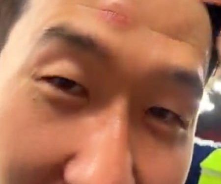 Kapetan Tottenham, sin Heung-Min, otišao je s Battle Scar nakon ozljede nakaza tijekom završnih proslava Europa lige