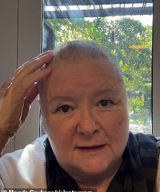 Magda Szubanski najavljuje dijagnozu raka četiri faze u razornom videozapisu