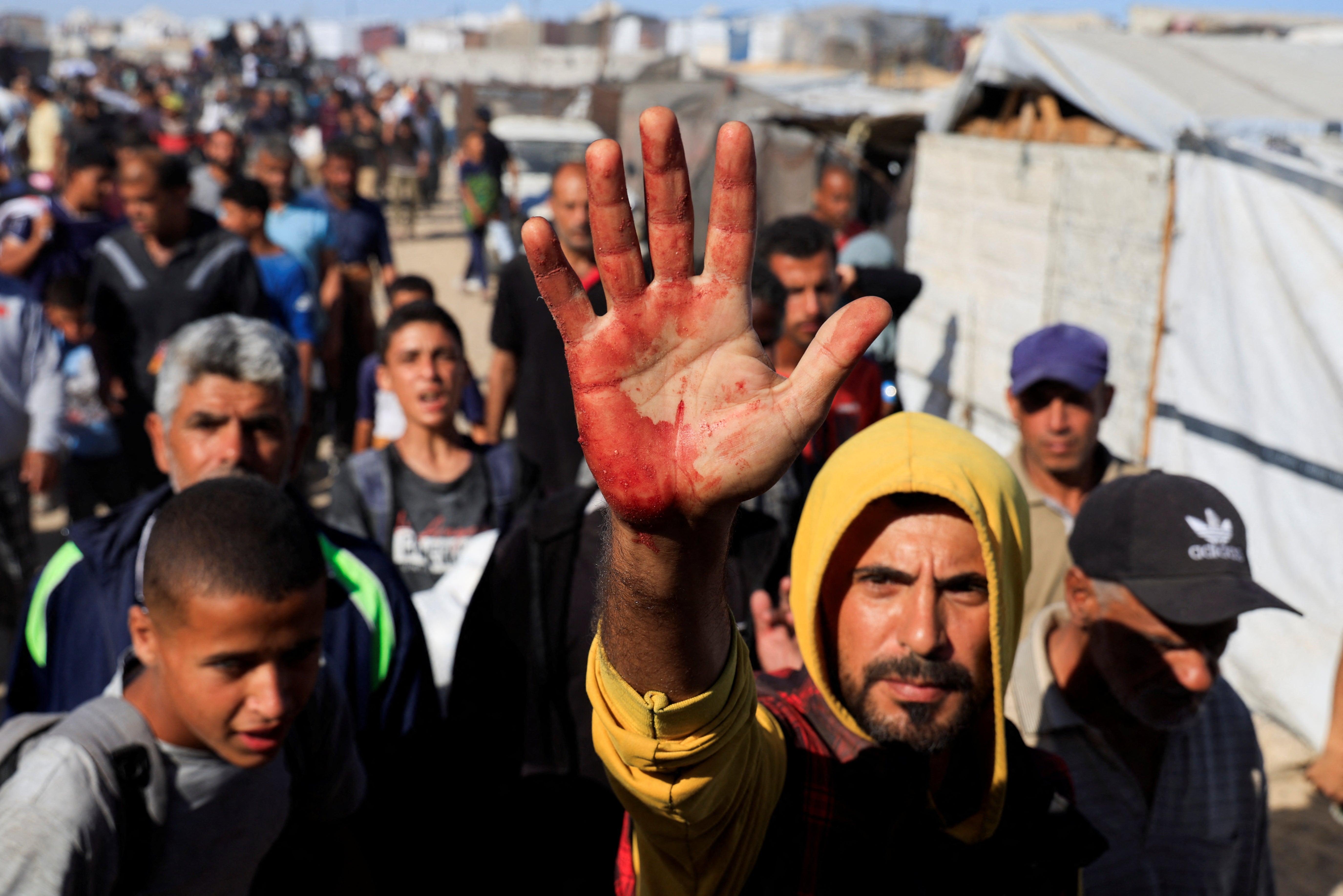 Palestinac pokazuje mrlje krvi na dlanu, nakon prikupljanja zaliha pomoći iz humanitarne zaklade Gaze podržane SAD-om