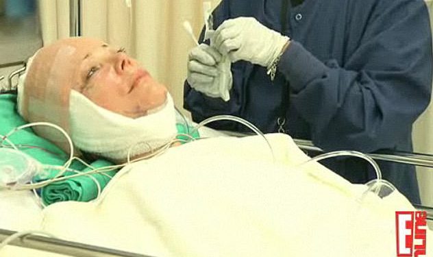 Prestravljena Kris Jenner ide pod nož radi podizanja lica u ponovnim snimkama dok je riješena misterija zbog njezine najnovije operacije