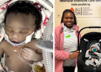 Prozvali su ga ‘Beba Lazar’, rođen bez otkucaja srca, vraćena u život: ‘Nikada to nisam vidjela’