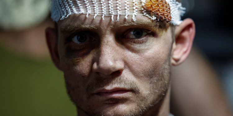 Ranjeni ukrajinski vojnici pitali su: “Prekid vatra, što primirje?”