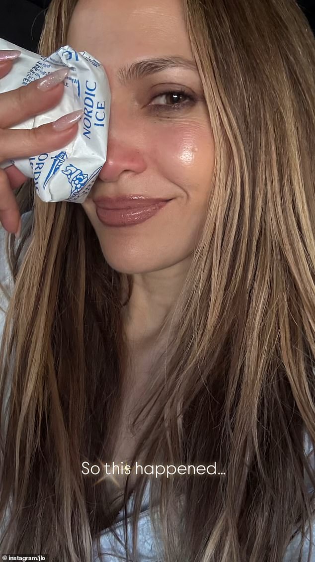 Uoči njezine svirke u ponedjeljak, Lopez je tijekom probati posebno pretrpio gadnu ozljedu nosa