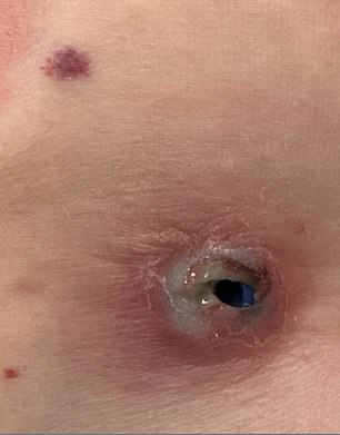 U svojoj parnici Miller je podijelio grafičku fotografiju onoga što tvrdi u prigovoru je 