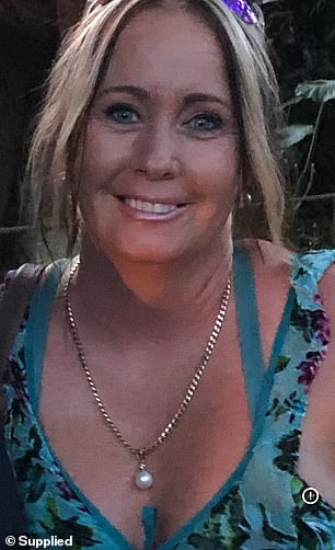 Annette Young prije njezinog zubnog stomatološkog rada u rukama dr. Davida Hursta