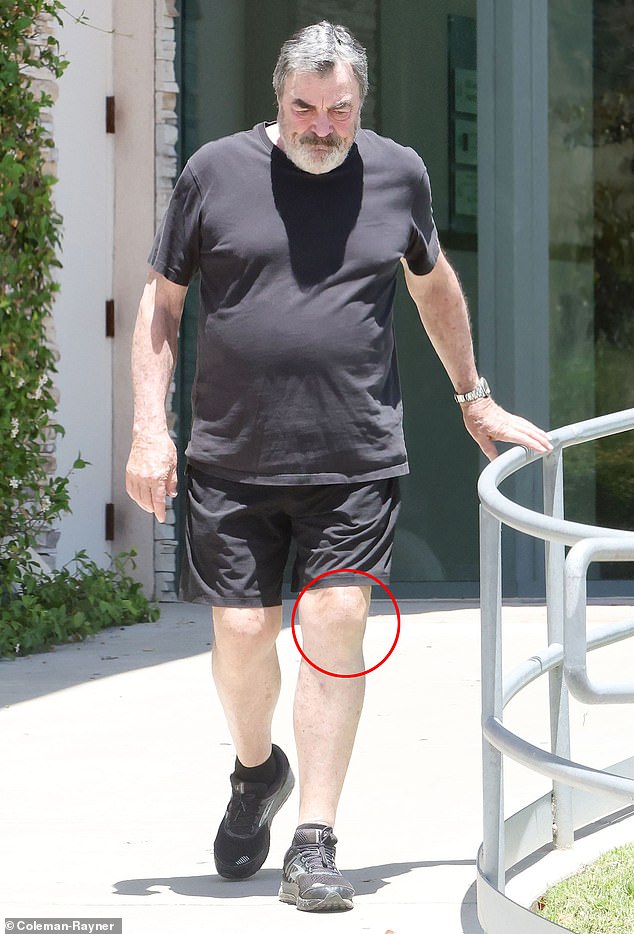 S godinama se Selleck primjetno usporio zbog povećanja težine i izvještaja o trajnom šepavanju. U srpnju 2024. godine, glasine su se okrenule kad su ga primijetili s onim što je izgledalo kao da su na koljenima ožiljci operacije