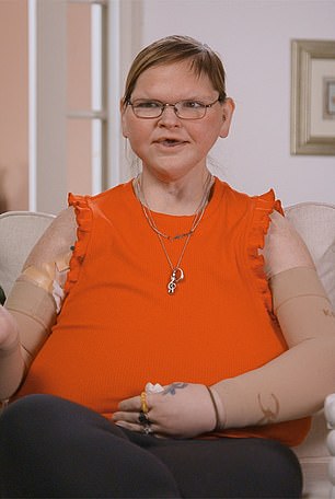 Prije i nakon pucnjava pokazali su veliku razliku
