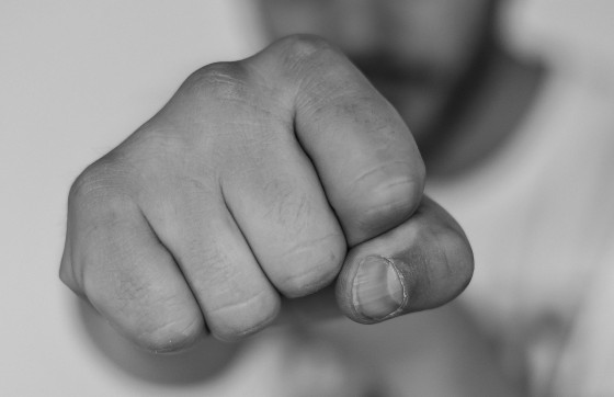 Detalji sukoba u Šuliću: Mladić je teško ozlijedio stariju ženu jer je fizički napala njegovu djevojku?