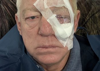 Footy obožavatelji prestrašeni su jer Channel Nine Star Phil Gould objavljuje jezivu sliku njegovog lica tijekom zdravstvene drame