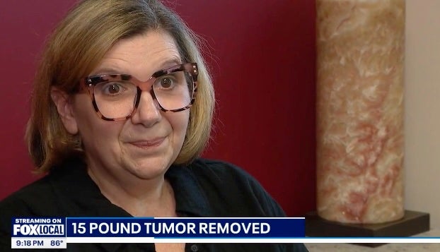 Julie Camarillo iz Michigana otputovala je 300 milja kako bi izvukla više od 15 kilograma iz želuca nakon što su liječnici kod kuće odbili raditi