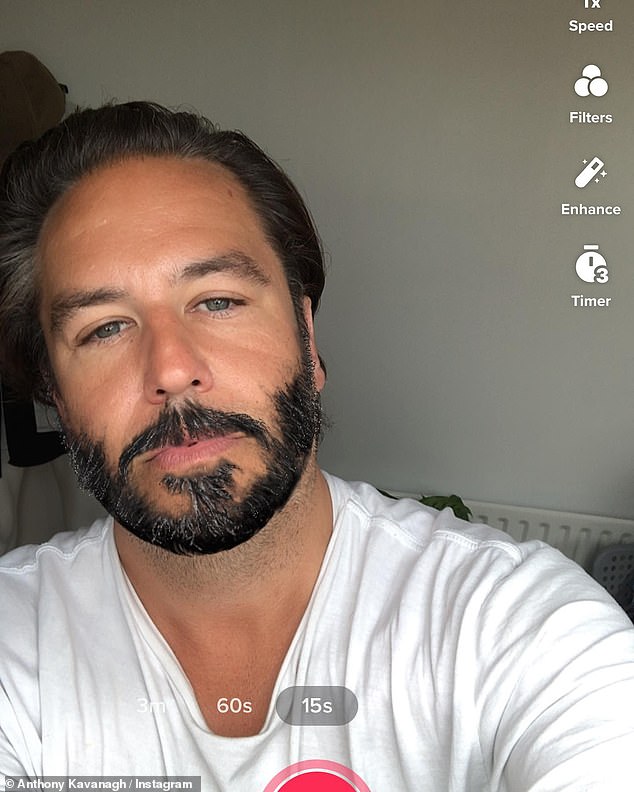 U svom novom memoaru, Anthony Kavanagh, koji je pod imenom Kavana postao slavu, podigao je poklopac na tamnijoj strani zvijezde svojom eksplozivnom autobiografijom, pop scars