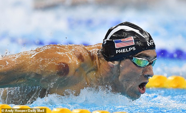 Heated glasses or cups are suctioned on to the skin to draw blood up to the surface in cupping