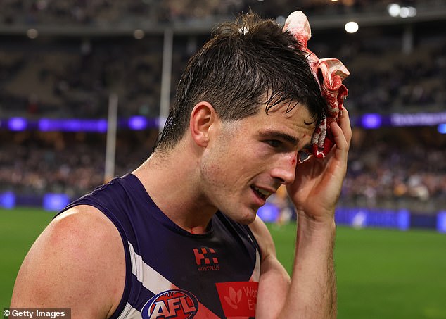 Brayshaw je ozlijeđen koljenom tijekom natječaja za označavanje u posljednjim minutama