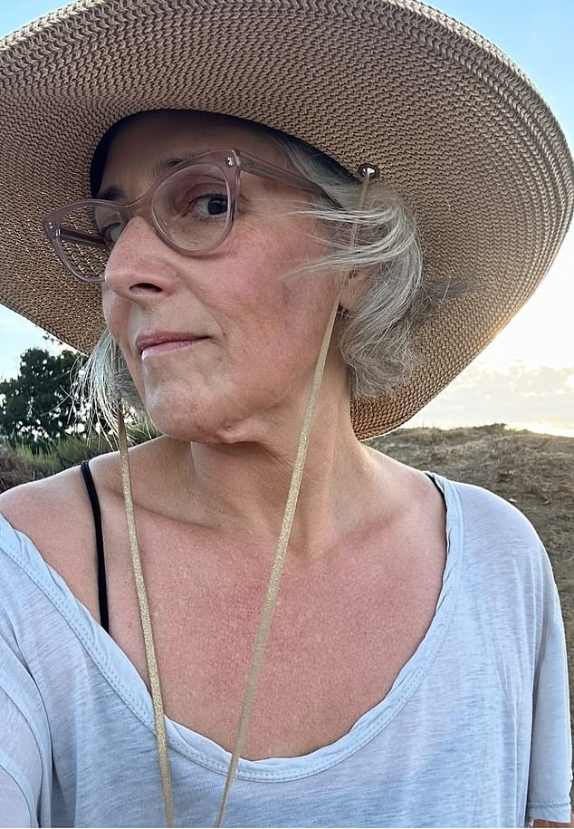 Objasnila je da je 'izgubila 40 kilograma i nije joj se svidjela dodatna koža koja je visjela ispod moje brade,' puštajući fanove da dobiju pogled na „područje koje mi se nije svidjelo“