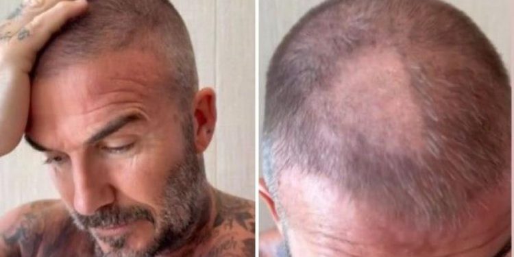 Beckham, kakva nevolja! A Victoria ga ismijava …