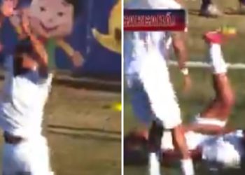 Brazil, on prolazi s ciljem poput CR7, ali … ozlijeđen je!