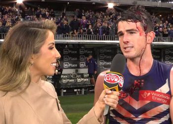 Footy navijači zapanjeni intervjuom nakon igre AFL Star nakon što su pretrpjeli šokantnu ozljedu