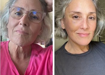 Ricki Lake, 56, otkriva koliko je prije nego što je zaista imala podizanje lica nakon što je javno izašla s postupkom