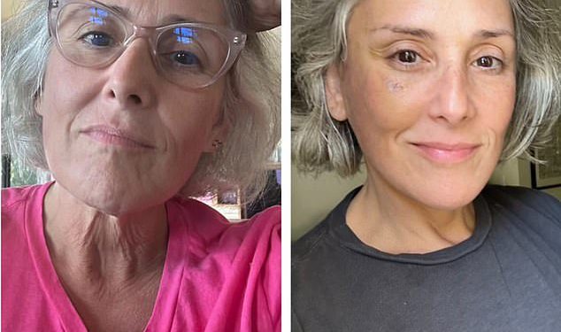 Ricki Lake, 56, otkriva koliko je prije nego što je zaista imala podizanje lica nakon što je javno izašla s postupkom