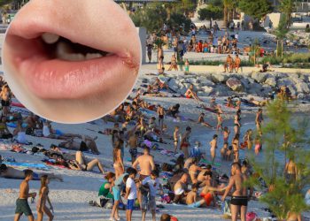 Slobodna Dalmacija – Roditelji, pripazite ako vam dijete dođe s mora i ospe se, možda je u pitanju ova zarazna bolest: ‘Da, ima slučajeva…’