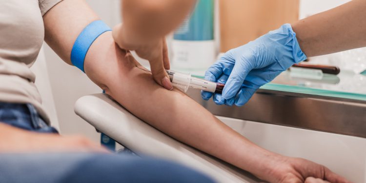 Svaka nizozemska osoba ima ‘zauvijek kemikalije’ u svojoj krvi – studij – RT World News