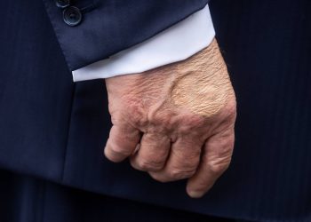 Trumpova neobična modrica odvija se ponovno pojavljivanje prije posjeta predsjedniku Pittsburghu