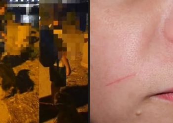 Užas na Čiovu: Netko je postavio “nevidljivu zamku” za motoriste, srećom nije se tragično završilo