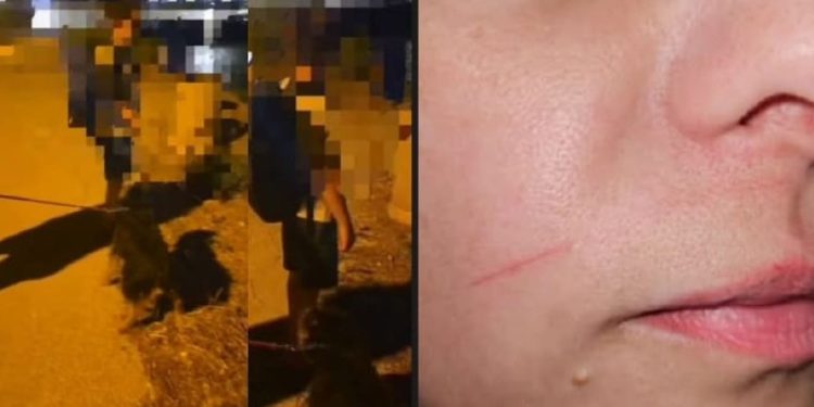 Užas na Čiovu: Netko je postavio “nevidljivu zamku” za motoriste, srećom nije se tragično završilo