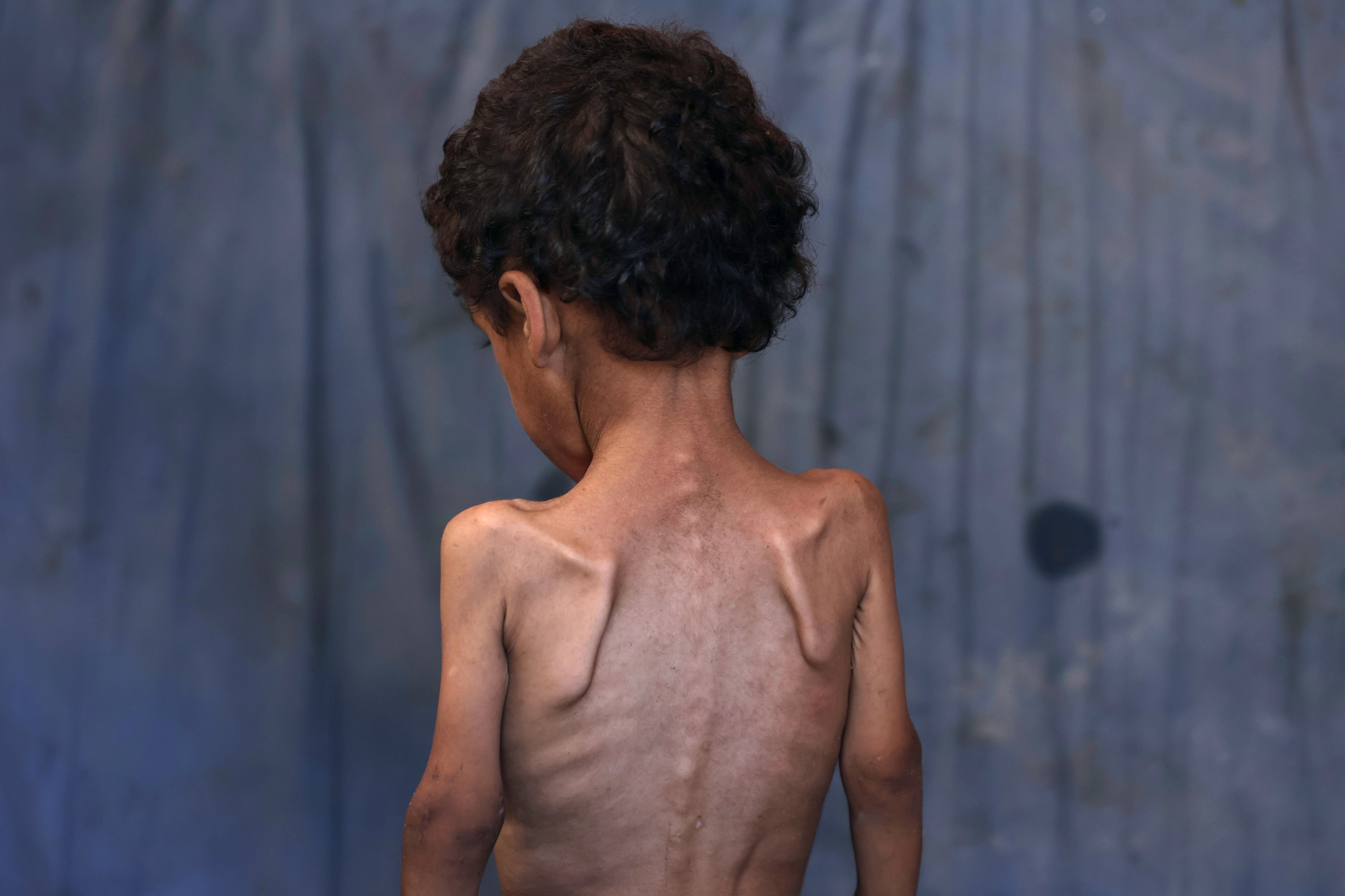 Yazan, pothranjeni dvogodišnji palestinski dječak, stoji s leđima okrenutim u oštećenom domu njegove obitelji u izbjegličkom kampu al-shita, zapadno od grada Gaze