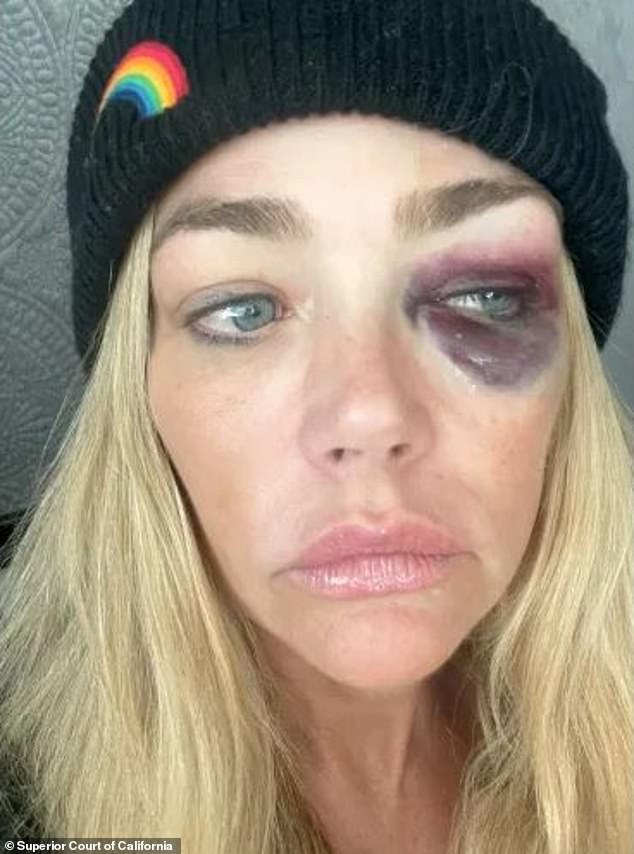 54-godišnja glumica, čiji je rascjep od Phypersa, 52, otkriven prošlog mjeseca, dobila je TRO 16. srpnja, nakon što je optužila Phypersa za fizičko i emocionalno zlostavljanje-što je odbio (fotografija iz Richardsovog zahtjeva za ograničenjem nasilja u obitelji)