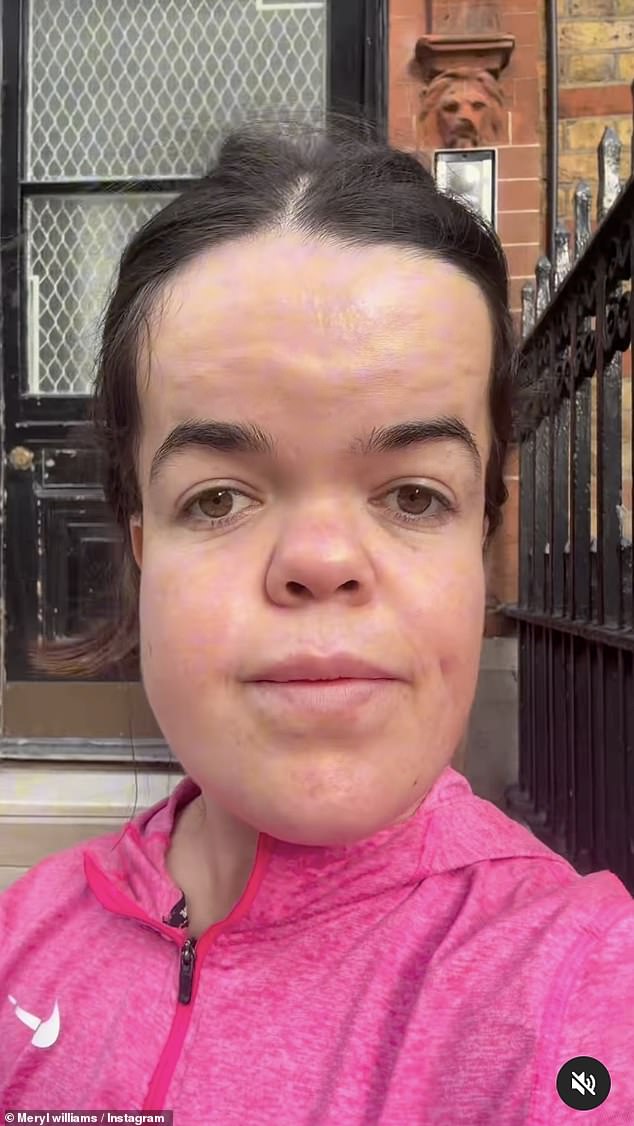 Pobjednik izdajnika 2022. godine odveo se na svoj Instagram kako bi rekao svojim sljedbenicima da je to željela raditi godinama i da mnogi ljudi nisu znali da ide pod nož