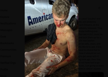 MAGA komentator moli da Trump da da “velike kuglice” medalju za slobodu daju nakon napada DC -a