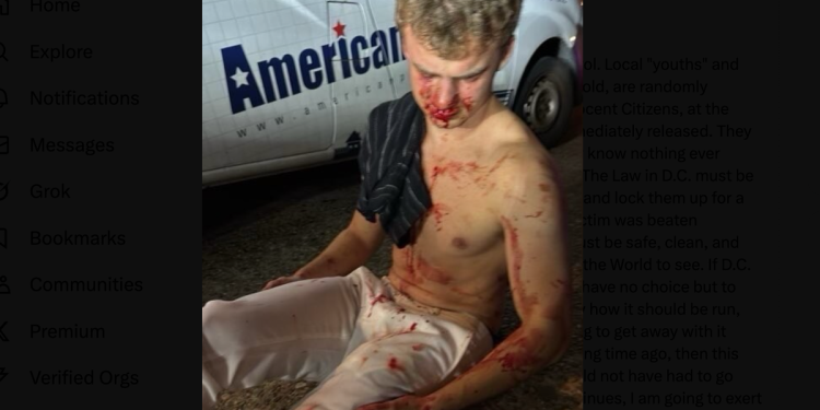 MAGA komentator moli da Trump da da “velike kuglice” medalju za slobodu daju nakon napada DC -a