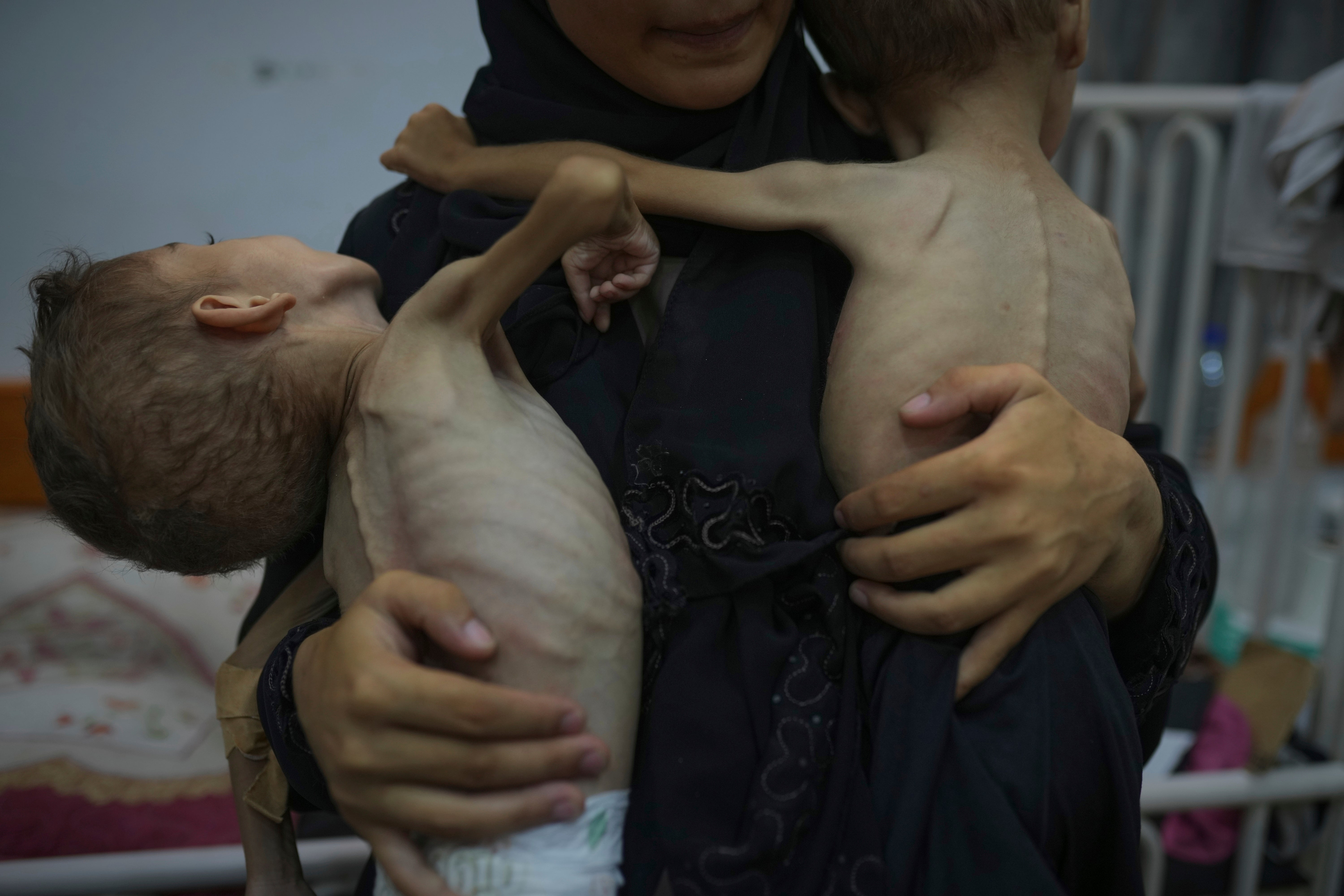 Omniya Mahra, drži se bez rukava za fotografiju njezine sinove Oday, 4, lijevo, i Mohammed, 3, koji pate od pothranjenosti i poremećaja genetskih živaca, kod prijatelja bolnice za pacijente u gradu Gaza, utorak, 29. srpnja 2025.