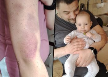 Obitelj Ujdur iz Doline Neretve u teškoj borbi: Pomoć za osnovne troškove je prijeko potrebna