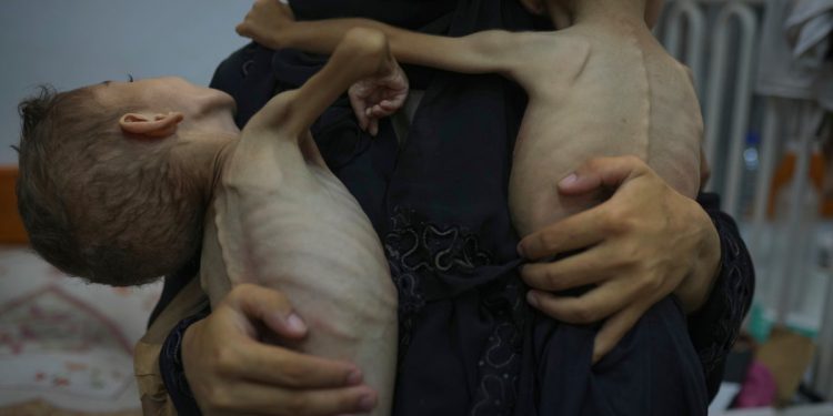 Stotine bolesne djece iz Gaze koja će biti evakuirana u Veliku Britaniju radi kritičkog liječenja NHS -a