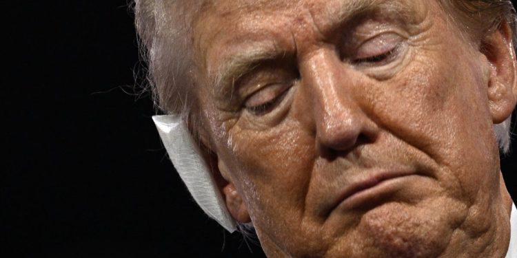 Trump je priznao da je ozljeda uha bila “previše loša” u RNC -u unatoč nošenju predimenzioniranog zavoja, kaže Kongresmen