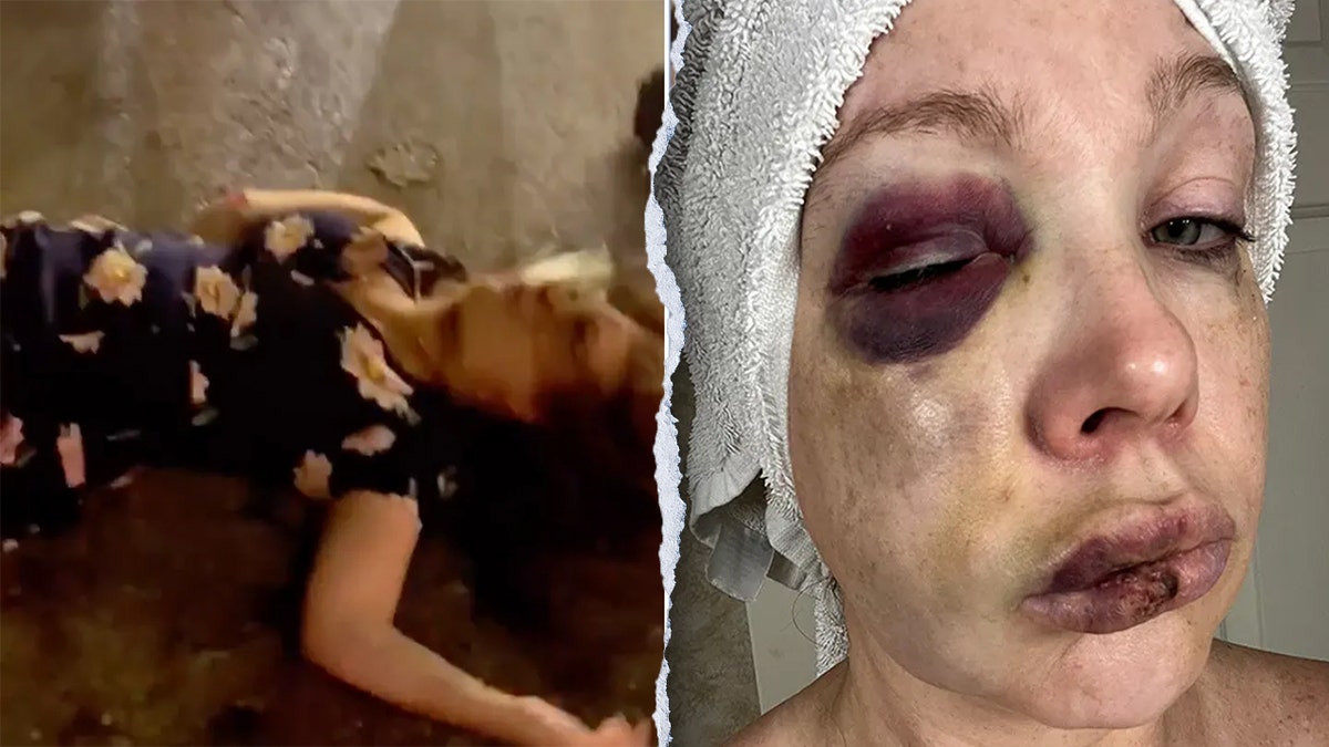 Cincinnati je pretukao žrtvu na zemlji, lijevo; Closeup pucao u redu