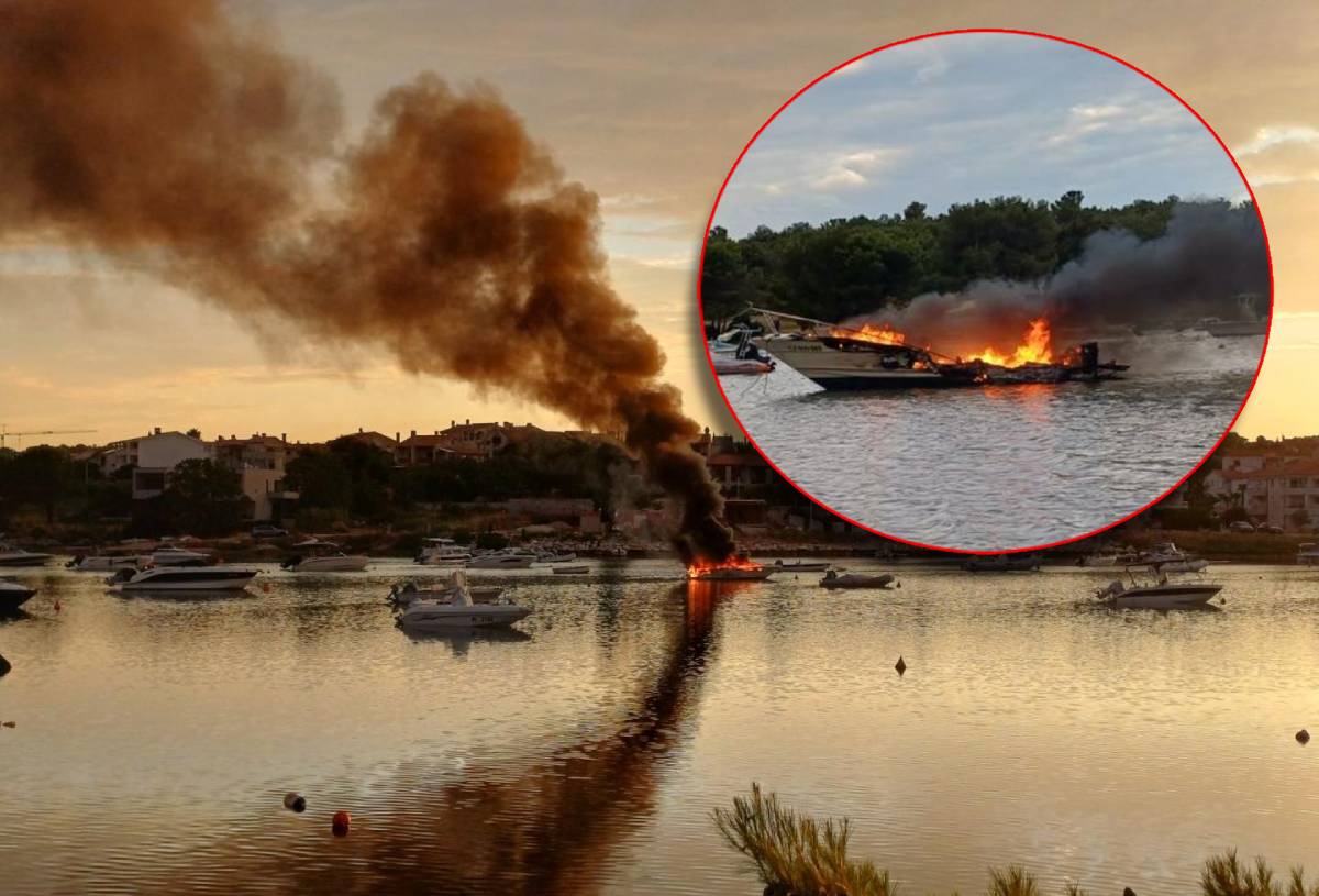 Pokušao ispumpati gorivo iz glisera u Medulinu, benzin se zapalio i teško ga ozlijedio!